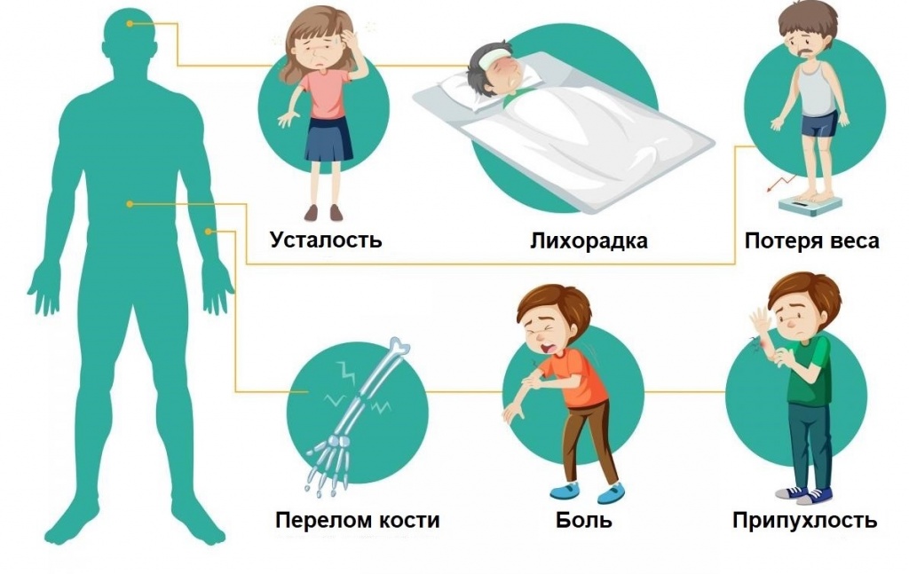 Хондромиксоидная фиброма Симптомы