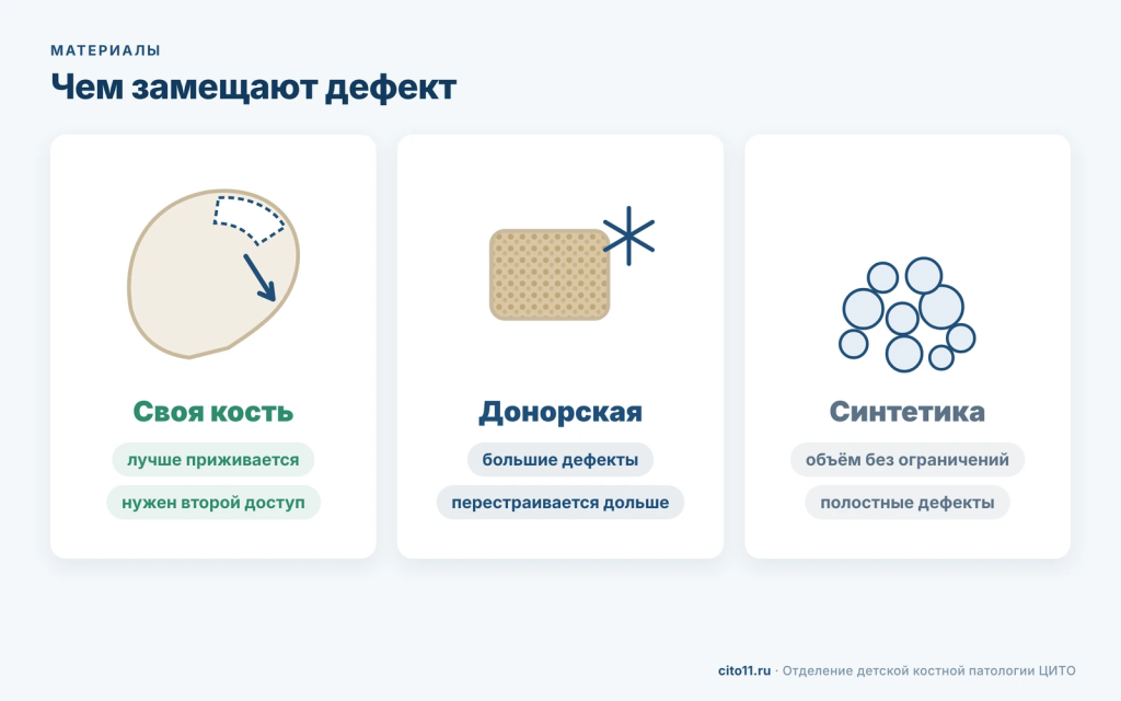 Материалы для костной пластики: собственная кость, донорская кость и синтетические заменители