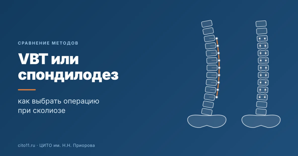 VBT или спондилодез: как выбрать операцию при сколиозе