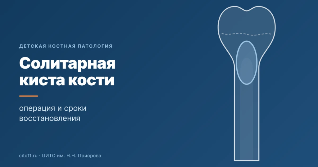 Солитарная (юношеская) киста кости у ребёнка: операция и восстановление
