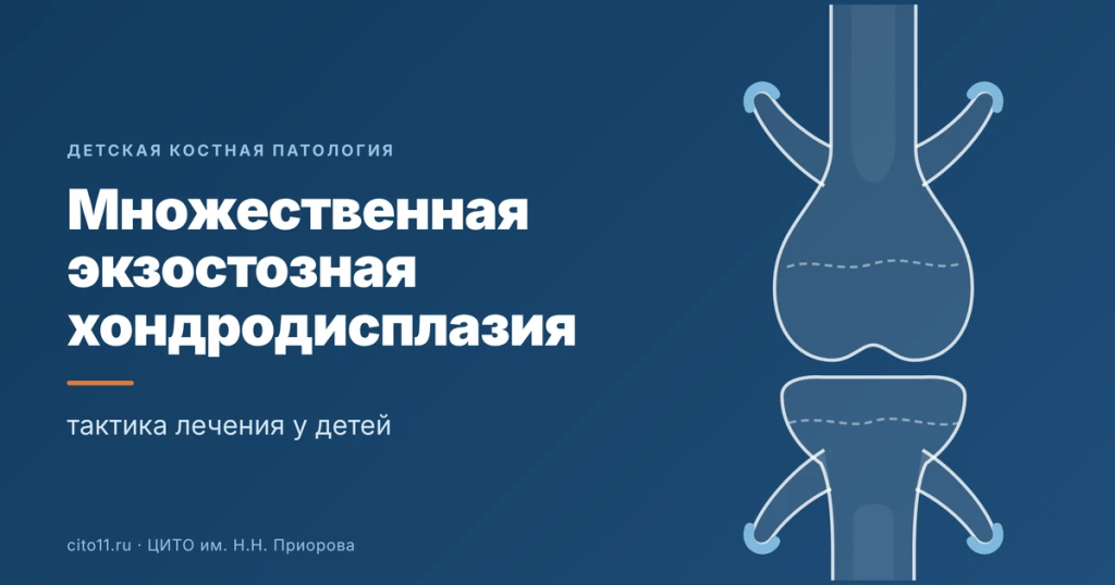 Множественная экзостозная хондродисплазия у детей: тактика лечения