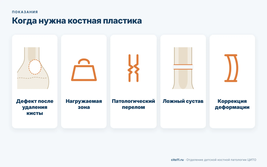 Показания к костной пластике у детей: дефект после удаления кисты, нагружаемая зона, патологический перелом, ложный сустав, коррекция деформации