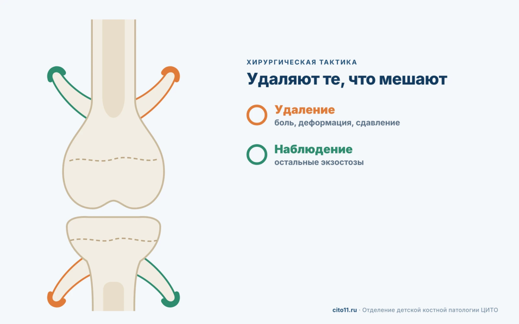 Хирургическая тактика при множественных экзостозах: удаляют мешающие экзостозы, остальные наблюдают