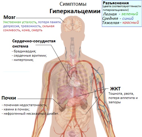 гиперкальциемия симптомы