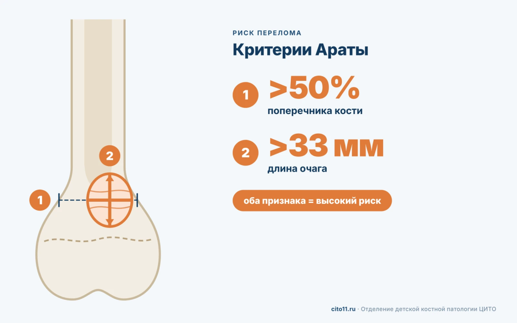 Критерии Араты: фиброма шире 50% поперечника кости и длиннее 33 мм относится к группе высокого риска перелома
