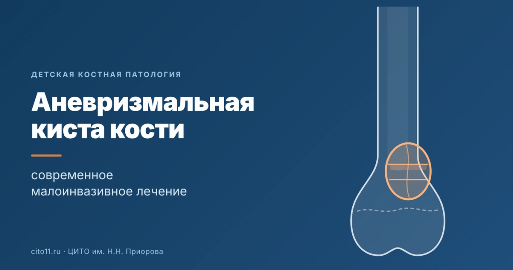 Аневризмальная киста кости у ребёнка: современное малоинвазивное лечение