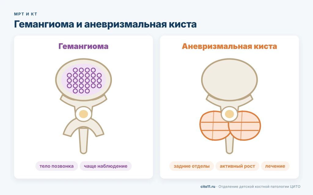 Гемангиома в теле позвонка и аневризмальная киста в задних отделах позвонка: схема различий
